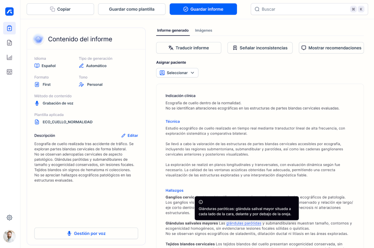 Ainovis screenshot 1
